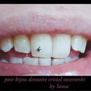 Bijou Dentaire